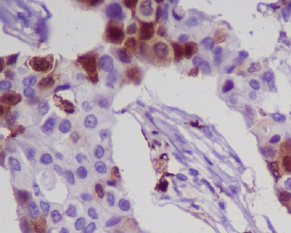 2 - Anti-MRP8 S100A8 Rabbit Monoclonal Antibody ABO13359
