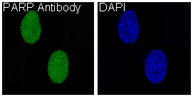 3 - Anti-PARP PARP1 Rabbit Monoclonal Antibody ABO13360