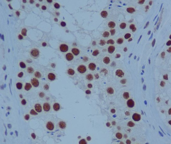 2 - Anti-PARP PARP1 Rabbit Monoclonal Antibody ABO13360