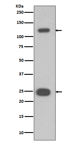 1 - Anti-PARP PARP1 Rabbit Monoclonal Antibody ABO13360