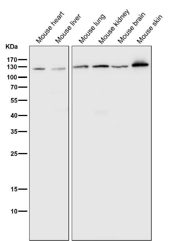 1 - Anti-PARP PARP1 Rabbit Monoclonal Antibody ABO13360