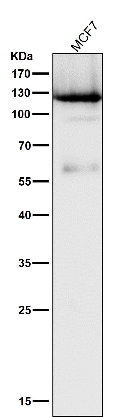 1 - Anti-PARP PARP1 Rabbit Monoclonal Antibody ABO13360