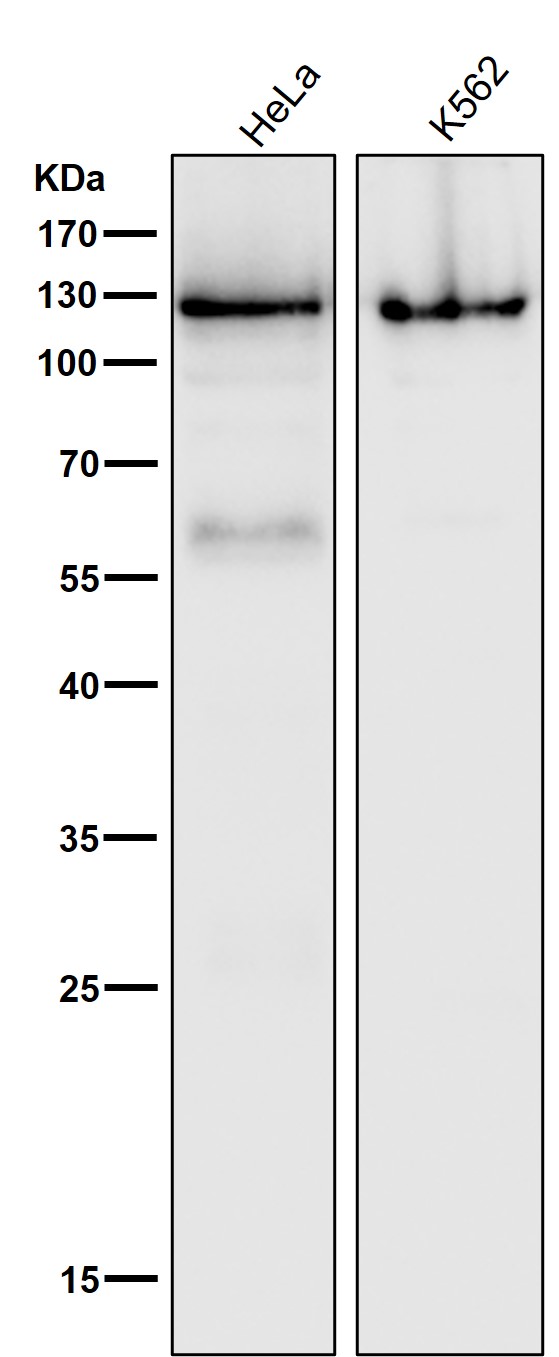1 - Anti-PARP PARP1 Rabbit Monoclonal Antibody ABO13360