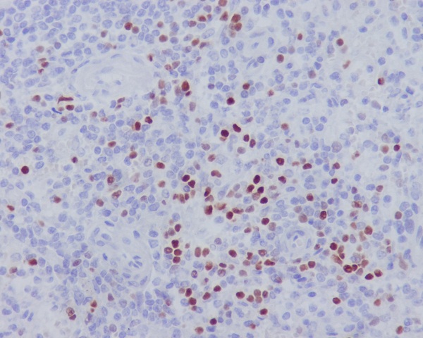 2 - Anti-LEF1 Rabbit Monoclonal Antibody ABO13361