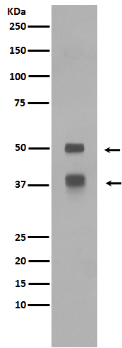 1 - Anti-LEF1 Rabbit Monoclonal Antibody ABO13361