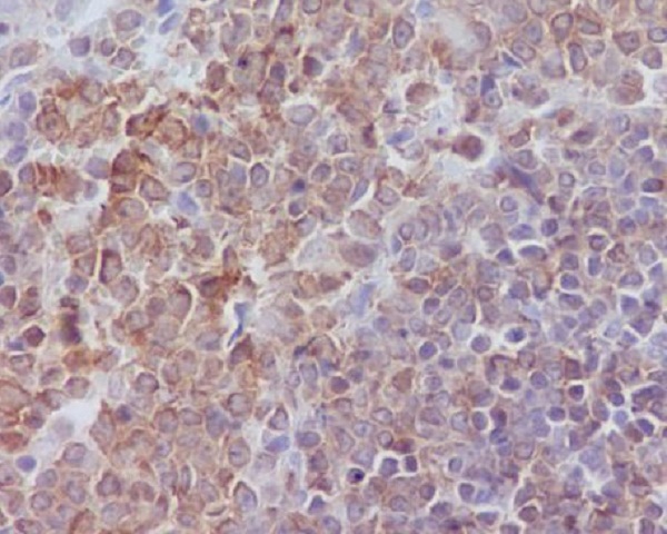 2 - Anti-SHP1 PTPN6 Rabbit Monoclonal Antibody ABO13362