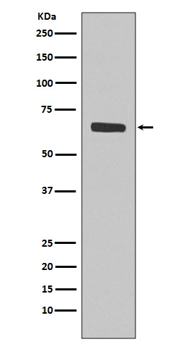 1 - Anti-SHP1 PTPN6 Rabbit Monoclonal Antibody ABO13362