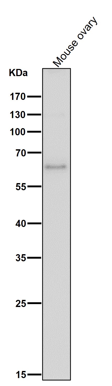 1 - Anti-ELK1 Rabbit Monoclonal Antibody ABO13364