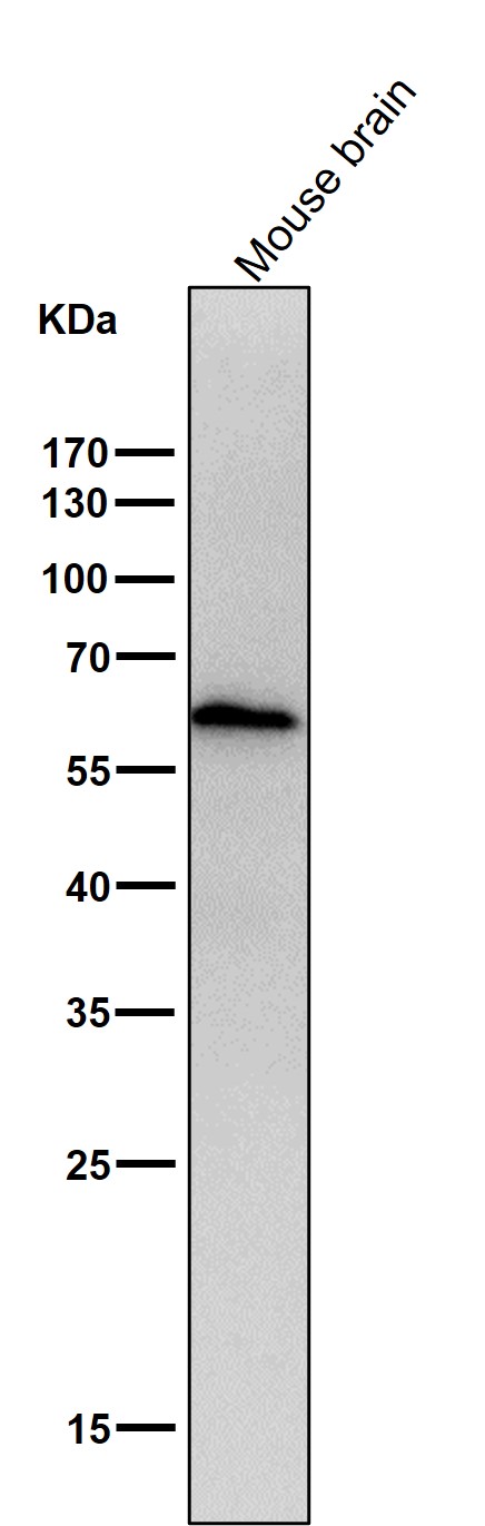 1 - Anti-ELK1 Rabbit Monoclonal Antibody ABO13364