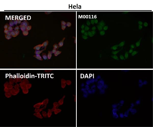 1 - Anti-YAP1/Yap Rabbit Monoclonal Antibody ABO13365
