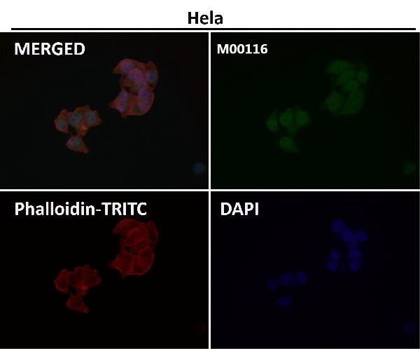 1 - Anti-YAP1/Yap Rabbit Monoclonal Antibody ABO13365