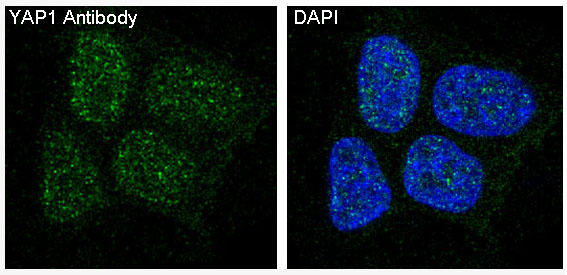 3 - Anti-YAP1/Yap Rabbit Monoclonal Antibody ABO13365