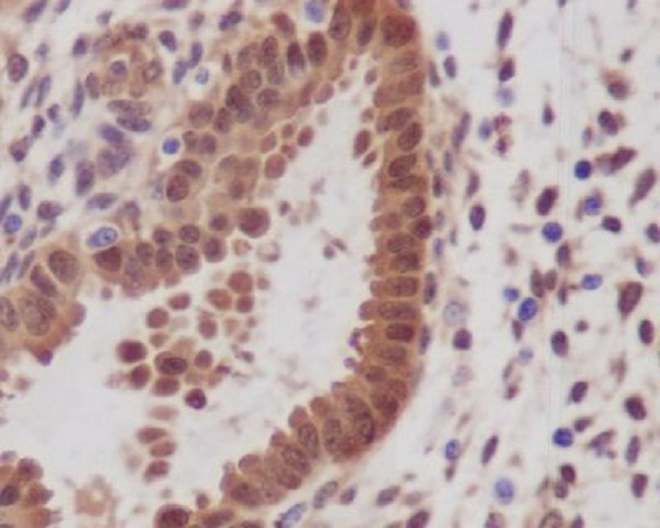2 - Anti-YAP1/Yap Rabbit Monoclonal Antibody ABO13365