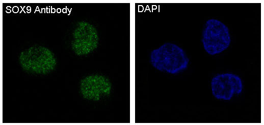 3 - Anti-SOX9 Rabbit Monoclonal Antibody ABO13366