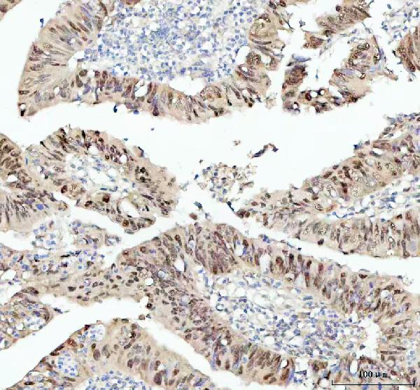 2 - Anti-SOX9 Rabbit Monoclonal Antibody ABO13366