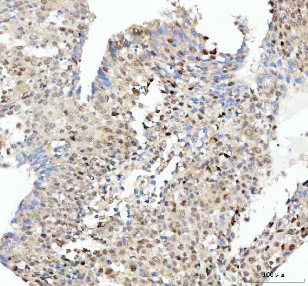 2 - Anti-SOX9 Rabbit Monoclonal Antibody ABO13366