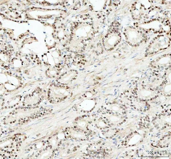 2 - Anti-SOX9 Rabbit Monoclonal Antibody ABO13366