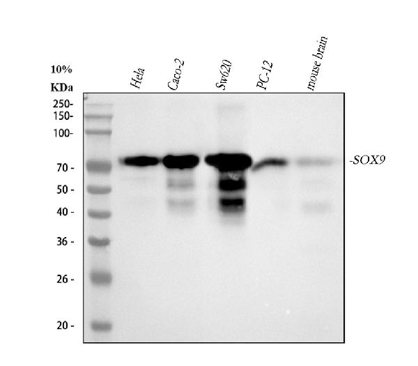 1 - Anti-SOX9 Rabbit Monoclonal Antibody ABO13366