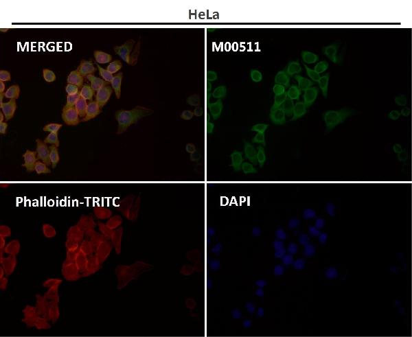 1 - Anti-CDK5 Rabbit Monoclonal Antibody ABO13367