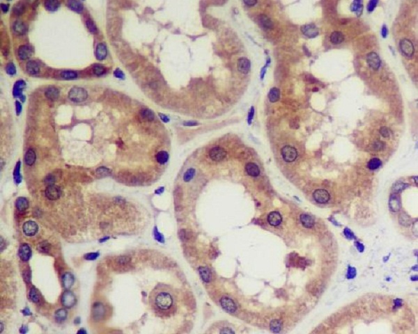 2 - Anti-CDK5 Rabbit Monoclonal Antibody ABO13367