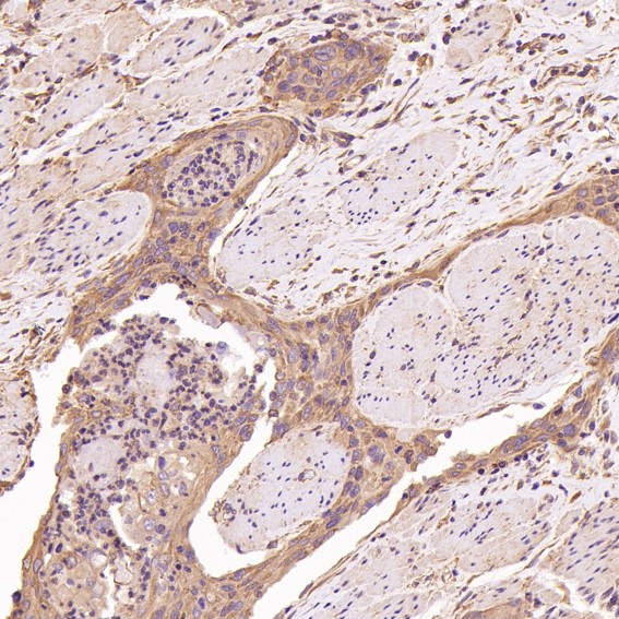 2 - Anti-CDK5 Rabbit Monoclonal Antibody ABO13367