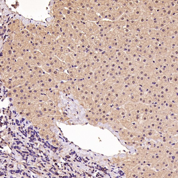 2 - Anti-CDK5 Rabbit Monoclonal Antibody ABO13367