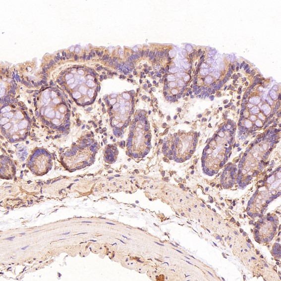 2 - Anti-CDK5 Rabbit Monoclonal Antibody ABO13367