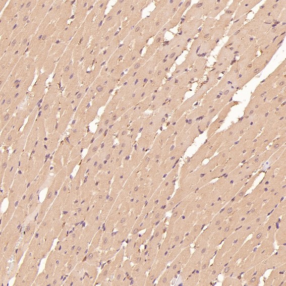 2 - Anti-CDK5 Rabbit Monoclonal Antibody ABO13367
