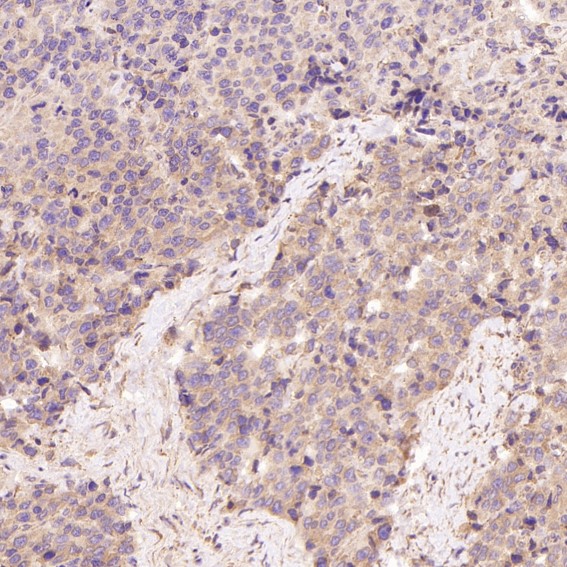 2 - Anti-CDK5 Rabbit Monoclonal Antibody ABO13367