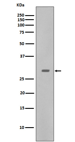 1 - Anti-CDK5 Rabbit Monoclonal Antibody ABO13367