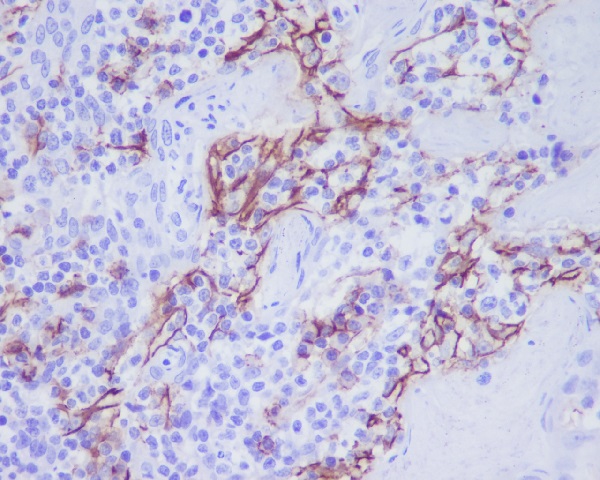 2 - Anti-CD31 PECAM1 Rabbit Monoclonal Antibody ABO13368