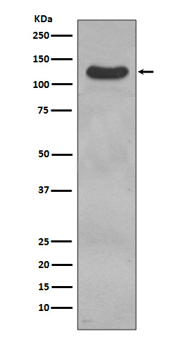 1 - Anti-CD31 PECAM1 Rabbit Monoclonal Antibody ABO13368