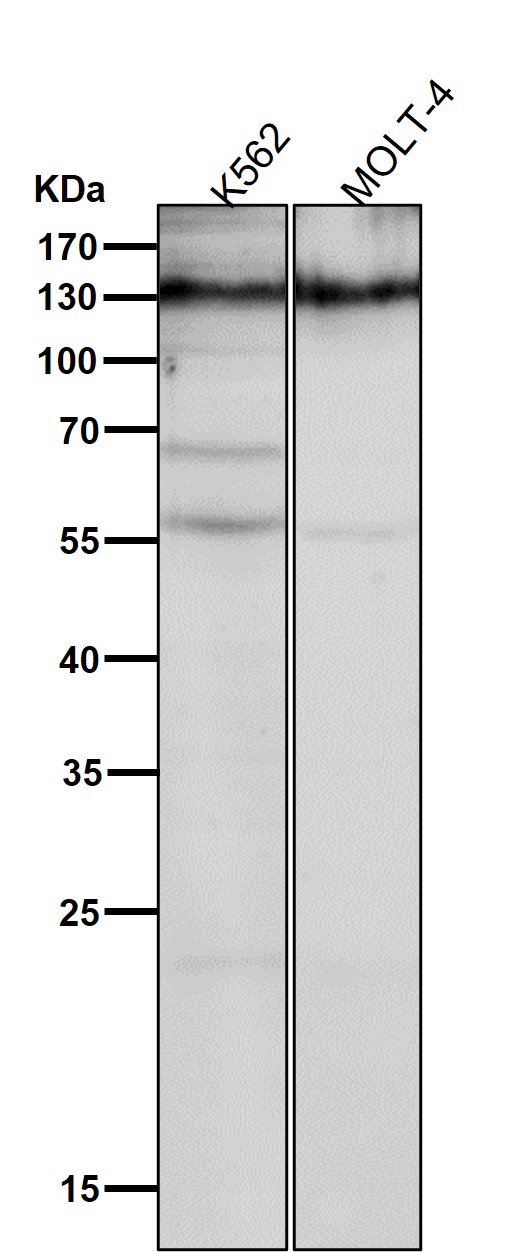 1 - Anti-CD31 PECAM1 Rabbit Monoclonal Antibody ABO13368