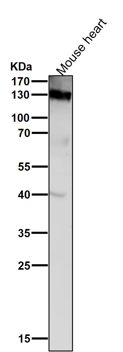 1 - Anti-CD31 PECAM1 Rabbit Monoclonal Antibody ABO13368