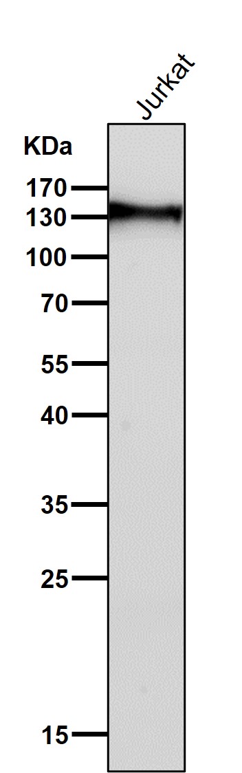 1 - Anti-CD31 PECAM1 Rabbit Monoclonal Antibody ABO13368