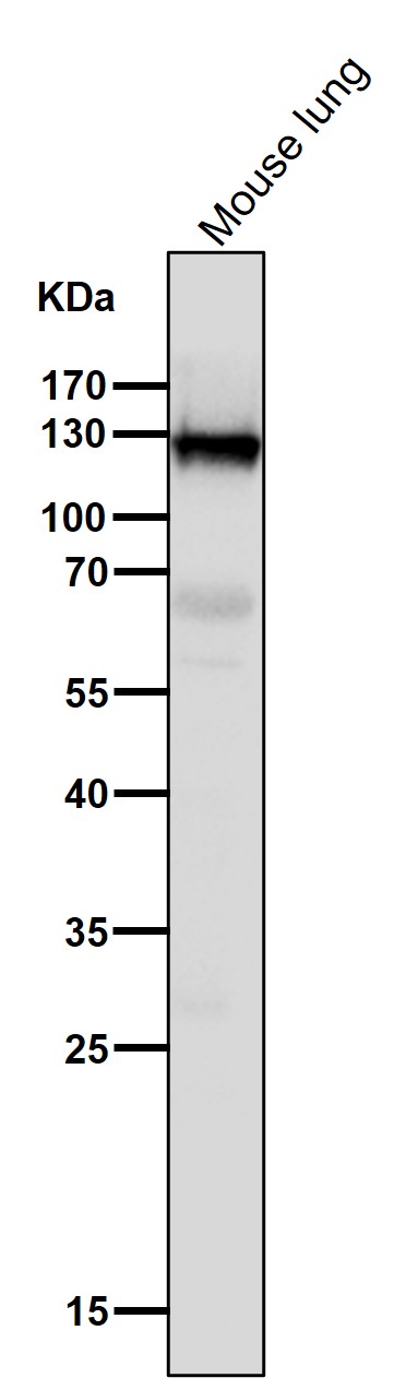 1 - Anti-CD31 PECAM1 Rabbit Monoclonal Antibody ABO13368