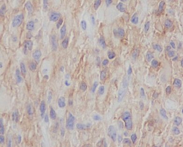 2 - Anti-NGFR/P75 Rabbit Monoclonal Antibody ABO13369