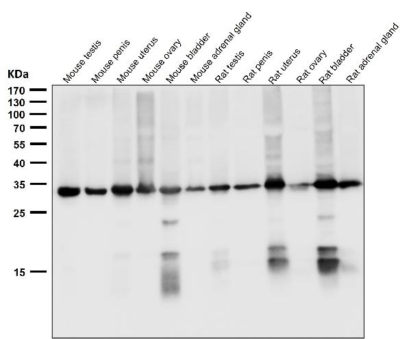 1 - Anti-NGFR/P75 Rabbit Monoclonal Antibody ABO13369