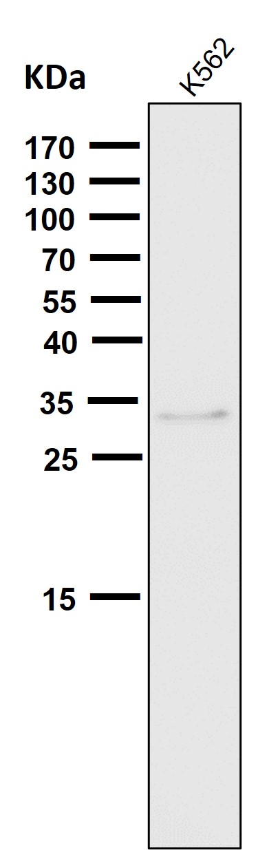 1 - Anti-NGFR/P75 Rabbit Monoclonal Antibody ABO13369