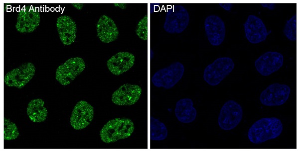 3 - Anti-Brd4 Rabbit Monoclonal Antibody ABO13371