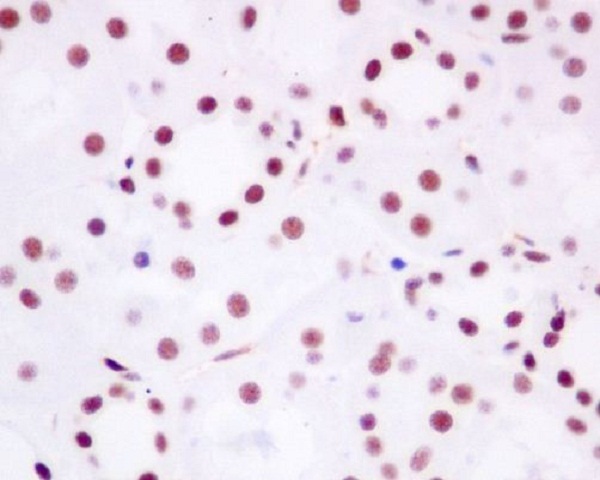 2 - Anti-Brd4 Rabbit Monoclonal Antibody ABO13371