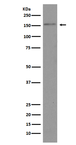 1 - Anti-Brd4 Rabbit Monoclonal Antibody ABO13371