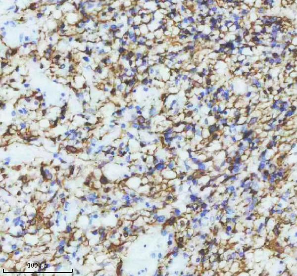 2 - Anti-GFAP Rabbit Monoclonal Antibody ABO13372