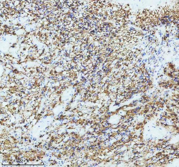 2 - Anti-GFAP Rabbit Monoclonal Antibody ABO13372