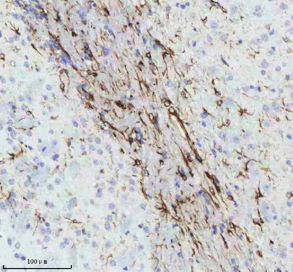 2 - Anti-GFAP Rabbit Monoclonal Antibody ABO13372