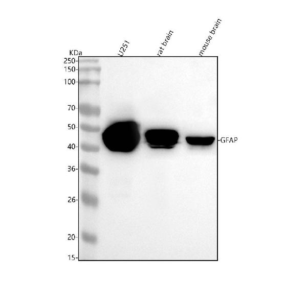 1 - Anti-GFAP Rabbit Monoclonal Antibody ABO13372