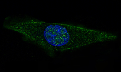 3 - Anti-GFAP Rabbit Monoclonal Antibody ABO13372