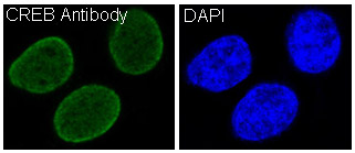 3 - Anti-CREB CREB1 Rabbit Monoclonal Antibody ABO13373