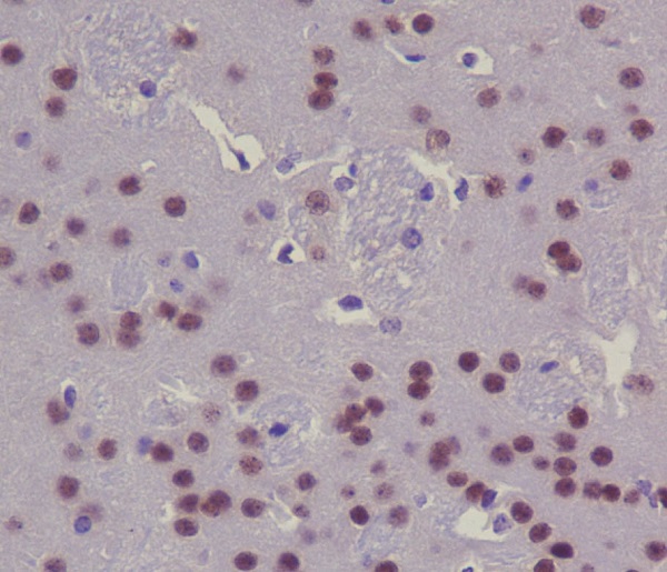 2 - Anti-CREB CREB1 Rabbit Monoclonal Antibody ABO13373