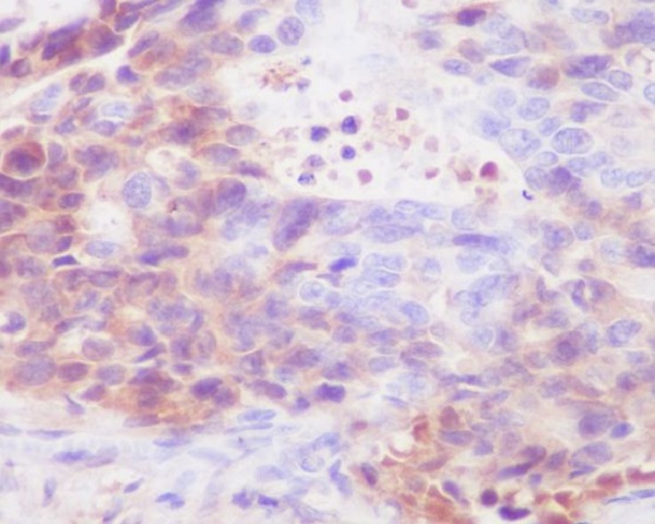 2 - Anti-IgG4 IGHG4 Rabbit Monoclonal Antibody ABO13374